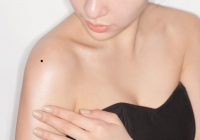 Nốt ruồi ở vai xui xẻo hay sung sướng